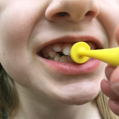 Ark Therapeutics Lippenverschluss Spielzeug Set - proButton™ für Lippenkraft-2